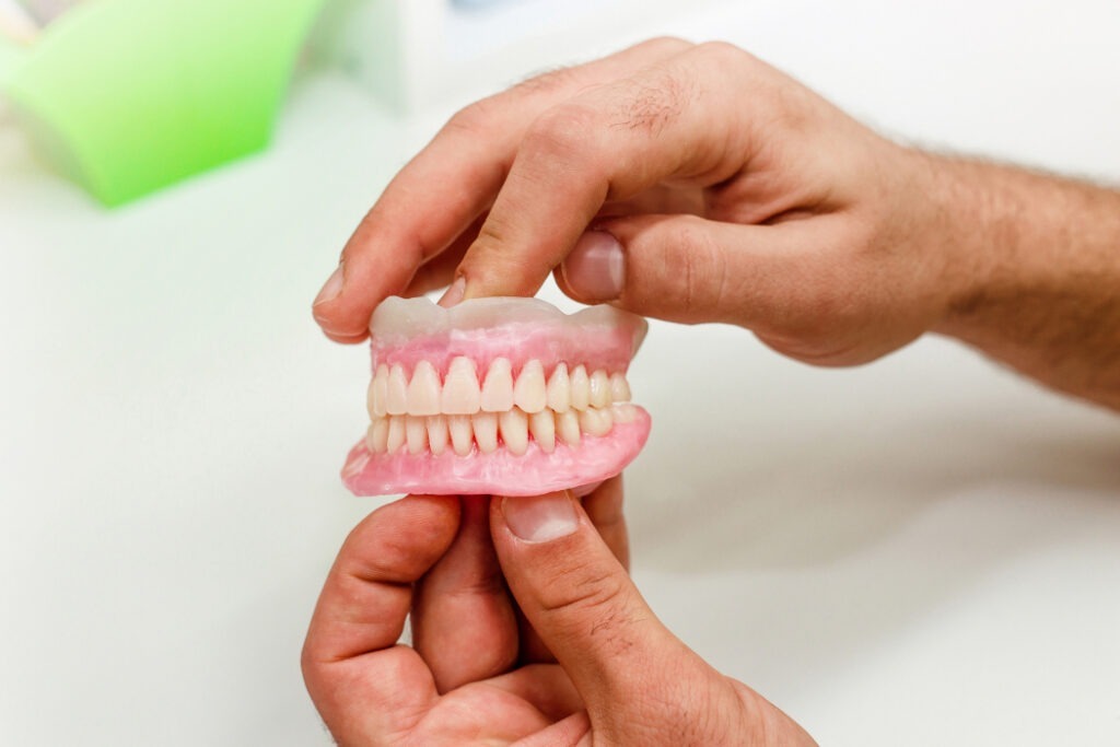 Full Mouth Mouth Dental Implant