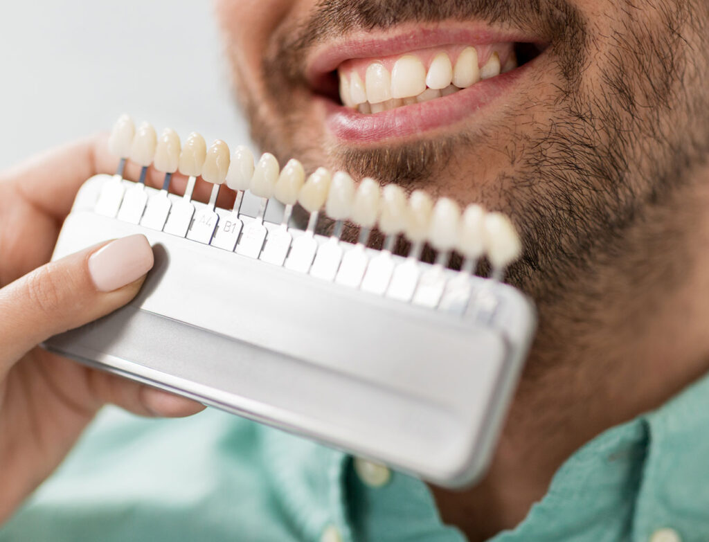 Porcelain Veneers