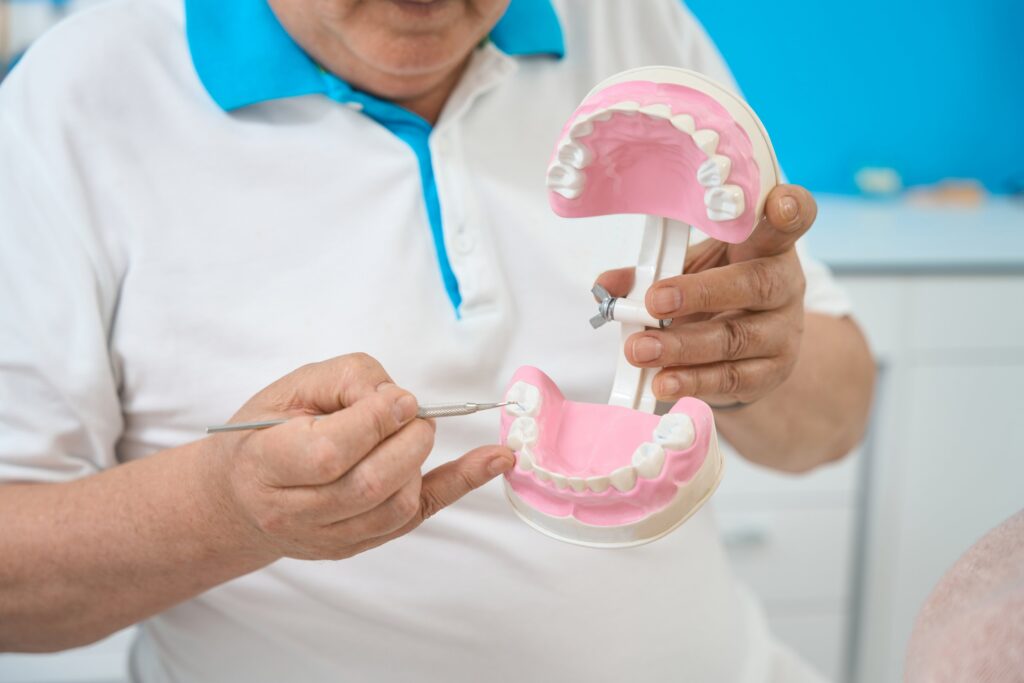 Can Invisalign fix an overbite? A dentist explains bite alignment on a jaw model