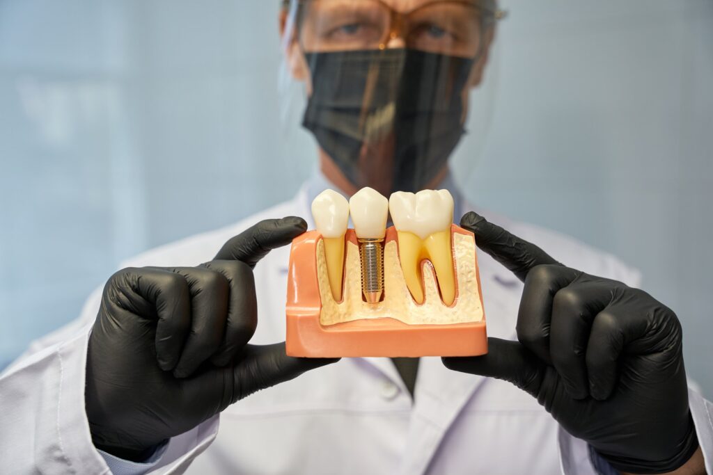 Does dental insurance cover implants? A dentist holds a model of an implant with a crown
