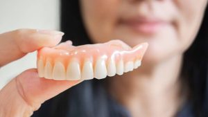 Snap On Dentures