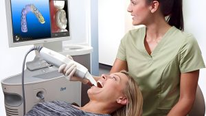 Invisalign Consultation