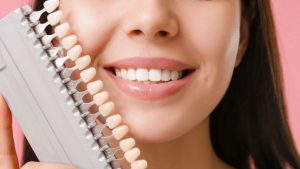 Dental Veneers