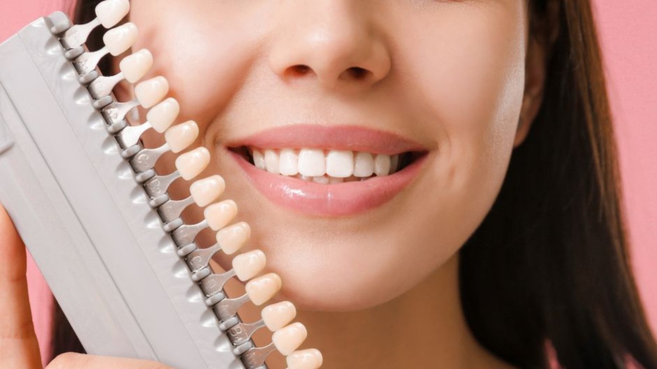 Dental Veneers