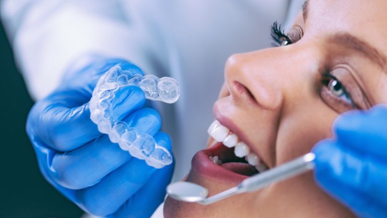 Invisalign